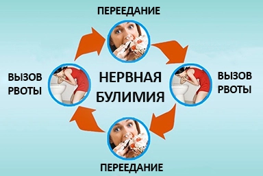 Лечение булимии в Верхнеуральске